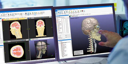 医用画像用ソフト - Simpleware ScanIP - Synopsys Simpleware Product Group - イメージ分析 / 3D ヴィジュアリゼーション / 医療用画像インポート