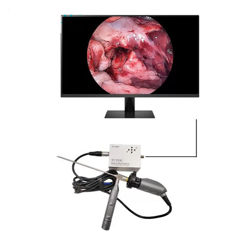 内視鏡用カメラ - TU-Y2HC - Shenzhen Tuyou Medical Imaging Co., Ltd.​ - 医療用 / デジタル / フルHD