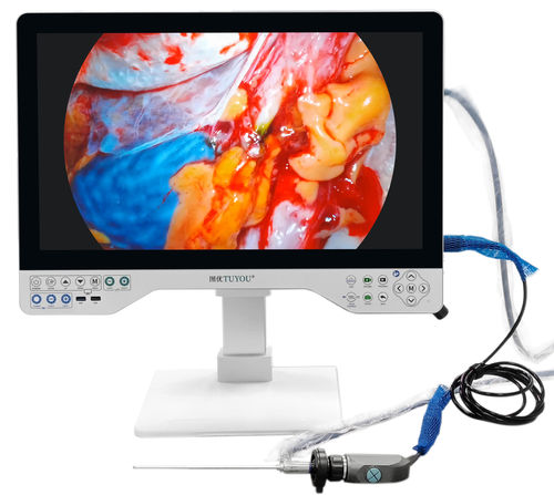 医療用カメラ - TU-15LSD1B - Shenzhen Tuyou Medical Imaging Co., Ltd.​ - 外科用 / デジタル / フルHD
