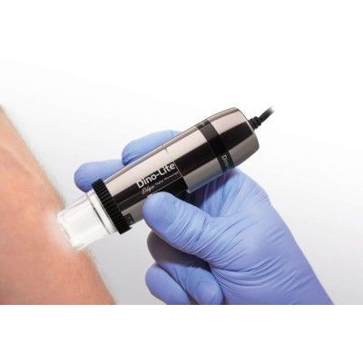 ビデオ皮膚鏡 - Dino-lite - Comitas e- Health - 白色LED