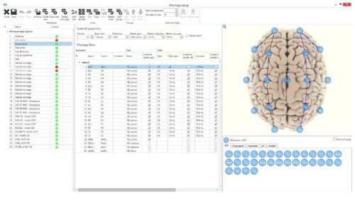 脳波図ソフト - BRAIN QUICK® - Natus Micromed - 管理用 / 分析 / モニター用