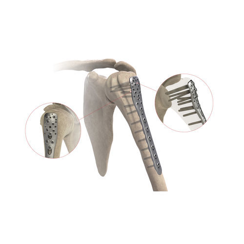 上腕骨用圧迫プレート - AS.SH.026 - Ases Orthopedics - 近位部 / 側面 / ロッキング