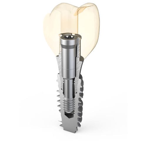 チタン製インプラントアバットメント - Master Fix - ARUM DENTISTRY Co., Ltd. - 外部 / 角度付き / スクリュー