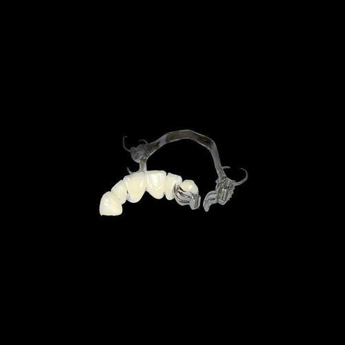 セラミック製歯科用ブリッジ - Shenzhen Alcadent Co.Ltd Alcadent Dental Laboratory - 下切歯 / 取り外し可能