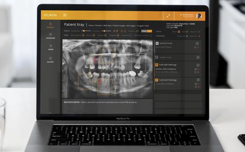 医用画像用AIプラットフォーム - Second Dentist ™ - VELMENI - 医療 / 歯科用 / 分析