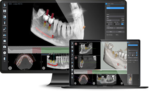 デザインソフト - Implant 3D - MediaLab - 3Dシミュレーション / 検査用 / 医療用