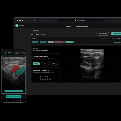 医療訓練用ソフト - ThinkSono - 超音波画像診断用