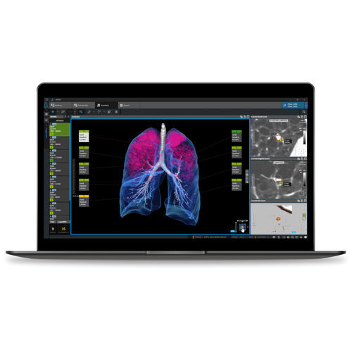 肺がん診断用ソフト - LCS  - Coreline - 医療用 / CT / イメージ分析