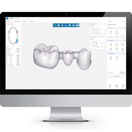 デザインソフト - DESIGN+ - DDS Inc - CAD / 診療所用 / 歯科用