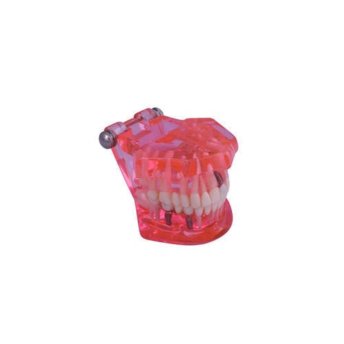 歯茎の解剖模型 - #A26 - CavoMed / 3D Dental - 歯並び用 / 根幹の / 歯科疾患