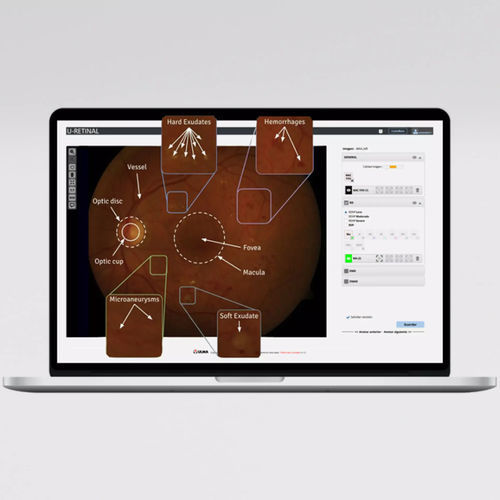 眼科AIプラットフォーム - UMI DR - ULMA Medical Technologies - 診断用 / 検出用