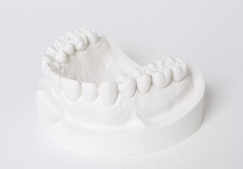 石膏歯科材料 - dento-stone® 220  - Dentona AG - 鋳造 / 義歯製造用 / 模型作成用