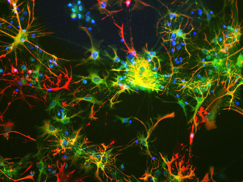 モノクローナル抗体試薬 - MO22143 - Neuromics - 科学研究用 / ウェスタンブロット法用 / 免疫組織化学用