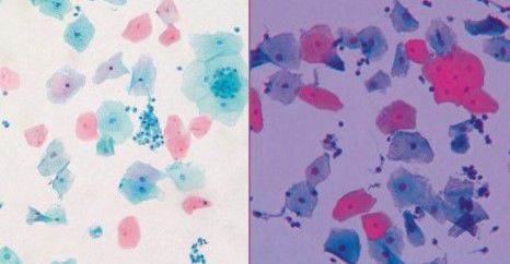染料試薬キット - Papanicolaou Stain - Wuhan Jinhong Biotech Development Co., Ltd. - 細胞学 / 診療所用