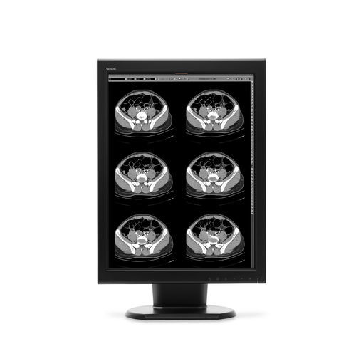診断用モニター - MX20N - Wide USA Corporation - 医用画像用 / 21.3インチ / LCD