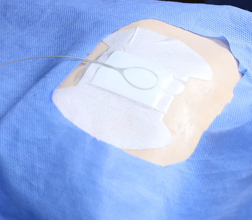 IVカテーテル固定 - Lock Plus - ACE Medical   - 腰用 / 貼るタイプの
