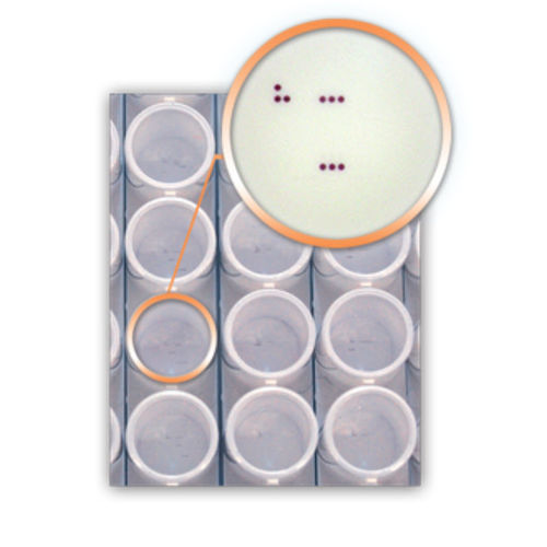 感染病用検査キット - DA4270 - AID , Autoimmun Diagnostika   - HPV / ヒトパピローマウイルス / 咽頭
