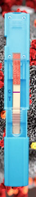 COVID-19用検査キット - Instant-view® PLUS - Alfa Scientific Designs - 抗原 / SARS-CoV-2 / 鼻咽頭