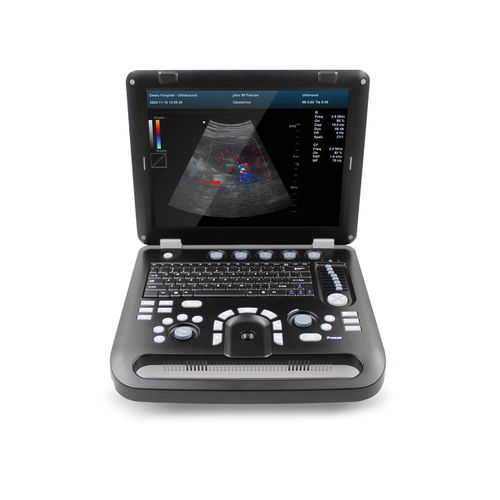 携帯型超音波装置 - CMS1700A  - Contec Medical Systems - 多目的超音波画像診断用 / 婦人・産科超音画像診断用 / 腹部・骨盤超音画像診断用