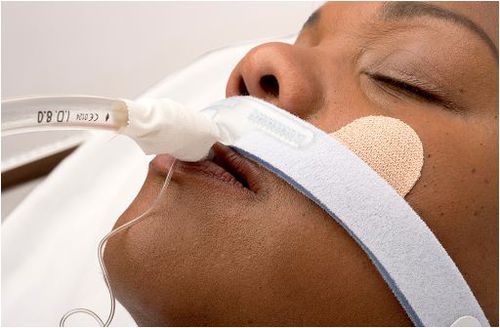 気管内チューブ固定 - Stabilock - Dale Medical Products - 頭用 / 貼るタイプの
