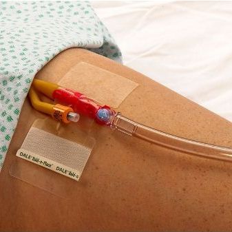 尿道カテーテル固定 - Hold-n-Place&reg; - Dale Medical Products - 脚用 / 貼るタイプの