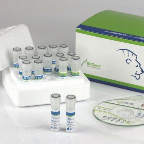 COVID-19用検査キット - 90078-RT - Elisabeth Pharmacon spol  - SARS-CoV-2 / 診療所用 / 血清