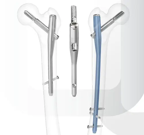 大特価！！ デアリバイク 高レート 調整パーツ付き スリーブ付き 68935-20813868.webp