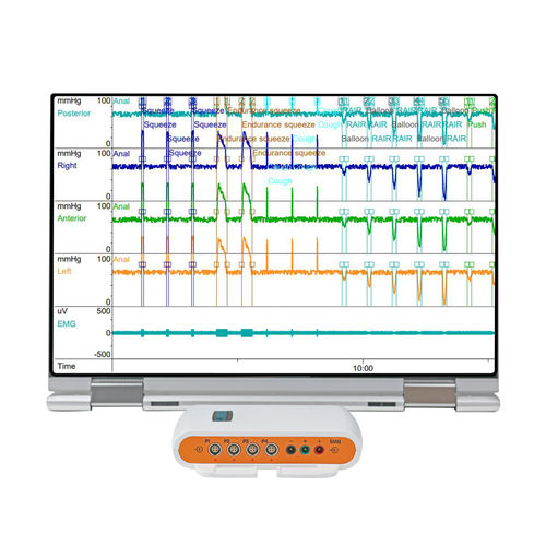 携帯型患者モニター - Solar™ Go  - Laborie Medical Technologies - マノメトリー / 集中治療用 / 大人用