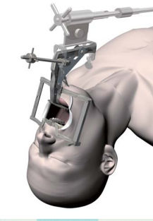 大人用咽頭鏡 - Satou - Nagashima Medical Instruments - 直角