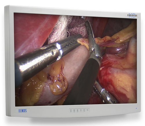 医療用モニター - EndoVue®  - NDS Surgical Imaging - 医用画像用 / 内視鏡用 / 高解像度
