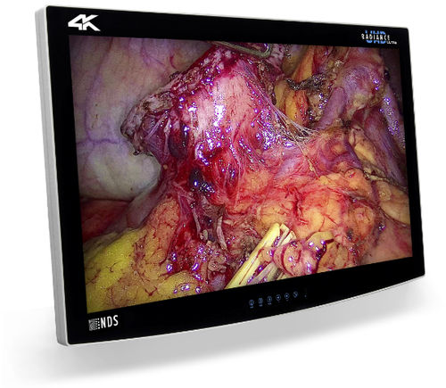 医療用モニター - RADIANCE® ULTRA - NDS Surgical Imaging - 外科用 / 4K解像度 / 32インチ