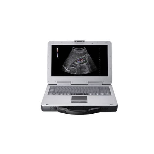 携帯型超音波装置 - Apogee 1000 Plus - SIUI - 多目的超音波画像診断用 / カラードップラー / 白黒