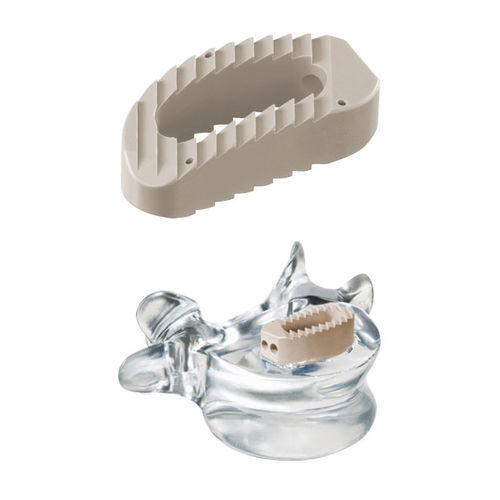 腰椎-仙椎の椎体間ケージ - pezo™ - ulrich medical - 側方進入 / PEEK製