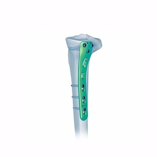 脛骨用圧迫プレート - Double Medical Technology - 近位部 / 後内側 / ロッキング
