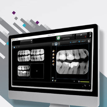 可視化ソフト - CS Imaging version 8 - Carestream Dental/ケアストリーム - データ管理 / 患者データ管理用 / 診断用