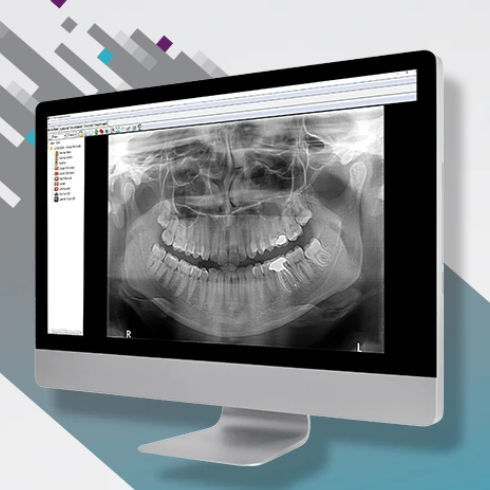 可視化ソフト - OMS - Carestream Dental/ケアストリーム - 分析 / 診断用 / リポーティング用