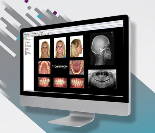 可視化ソフト - CS Orthodontic Imaging Software - Carestream Dental/ケアストリーム - データ管理 / 患者データ管理用 / 診断用