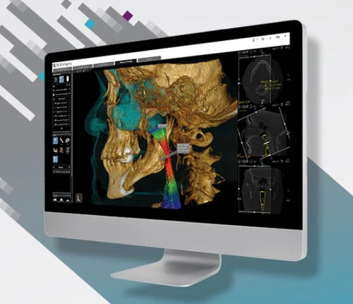 3D ヴィジュアリゼーションソフトウェアモジュール - CS Airway Module - Carestream Dental/ケアストリーム - コンタリング / 輪郭検出 / 測定用