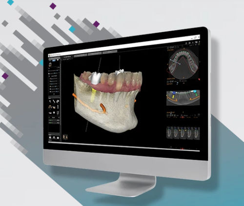 可視化ソフト - CS 3D - Carestream Dental/ケアストリーム - 分析 / 患者データ管理用 / 診断用