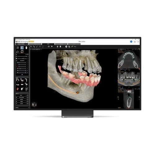 診療所用ソフト - CS 3D Imaging Premium - Carestream Dental/ケアストリーム - 歯科用 / インプラント用 / 口腔外科用