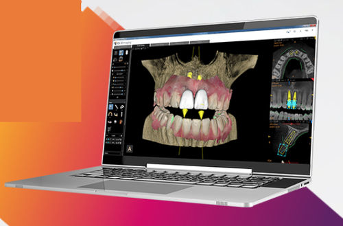 管理用ソフトウェアモジュール - Carestream Dental/ケアストリーム - デザイン / 処理 / リポーティング用