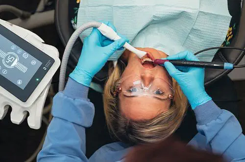 超音波歯科用スケーラー - Cavitron® 300 series - Dentsply Sirona