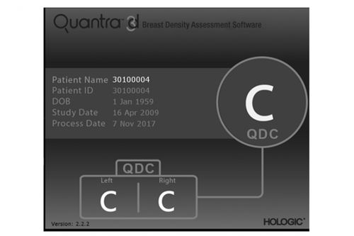 マンモグラフィー用ソフト - Quantra™ - Hologic - 医療用 / リポーティング用 / CAD
