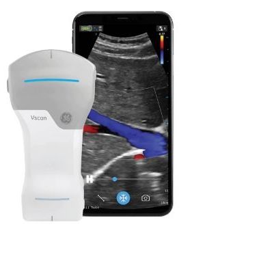 手持ち式超音波装置 - Vscan Air™ - GE Healthcare - 多目的超音波画像診断用 / 白黒 / カラードップラー