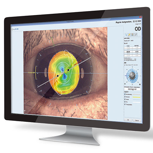 計画用ソフト - EyeSuite IOL  - Haag-Streit Diagnostics - 測定用 / 眼科手術 / 解剖学