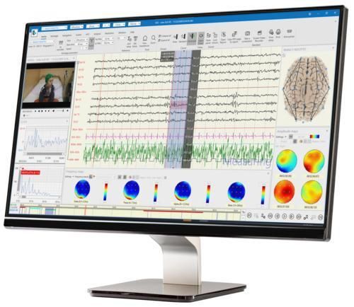 可視化分析・管理システム - BRAIN QUICK® - Natus Hearing & Balance - DICOMファイル用 / 診断用 / シグナル