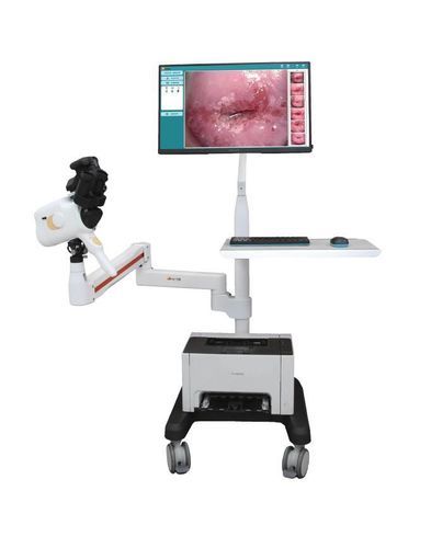 デジタルコルポスコープ - V1-V2 - Guangzhou Sunray Medical Equipment Co., Ltd. - 台車上