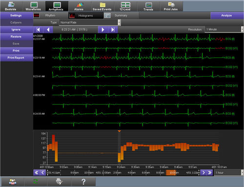 可視化ソフト - Smart Disclosure - Spacelabs Healthcare - 時刻同期 / アラーム / ECG用