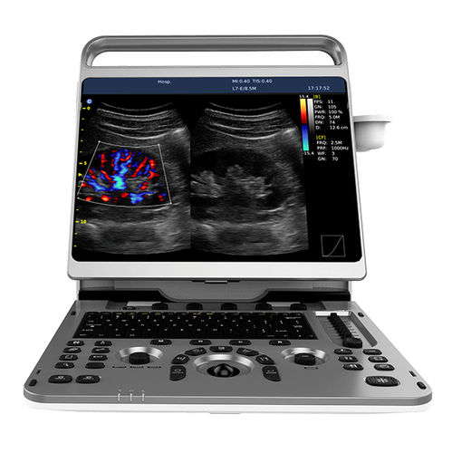 携帯型超音波装置 - Ebit 50 - CHISON Medical Technologies - 多目的超音波画像診断用 / カラードップラー / 白黒