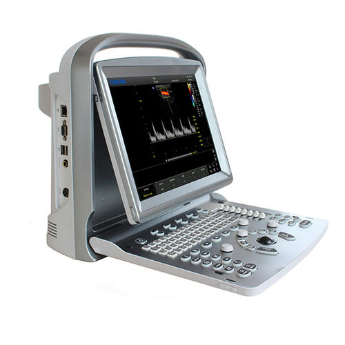 携帯型超音波装置 - ECO 5 - CHISON Medical Technologies - 多目的超音波画像診断用 / カラードップラー / 白黒